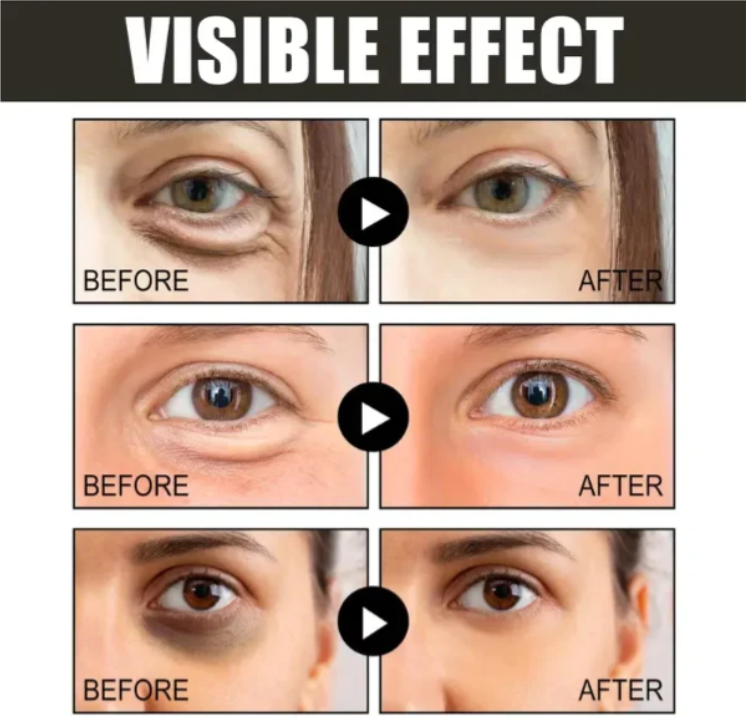 (🔥Kupi 1 dobi 1 gratis🔥)Krema za područje oko očiju s kofeinom