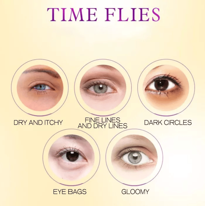 （🔥Kupi 1 dobi 1 gratis🔥）Krema za privremeno učvršćivanje područja oko očiju