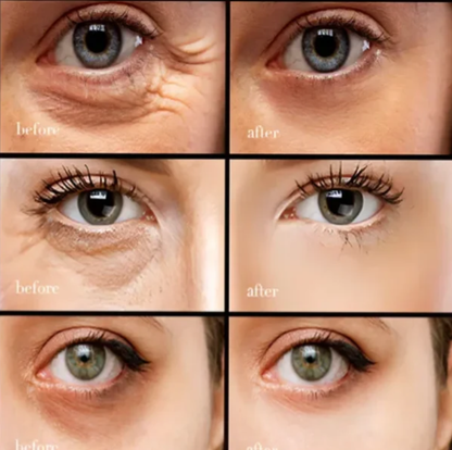 （🔥Kupi 1 dobi 1 gratis🔥）Krema za područje oko očiju s kofeinom